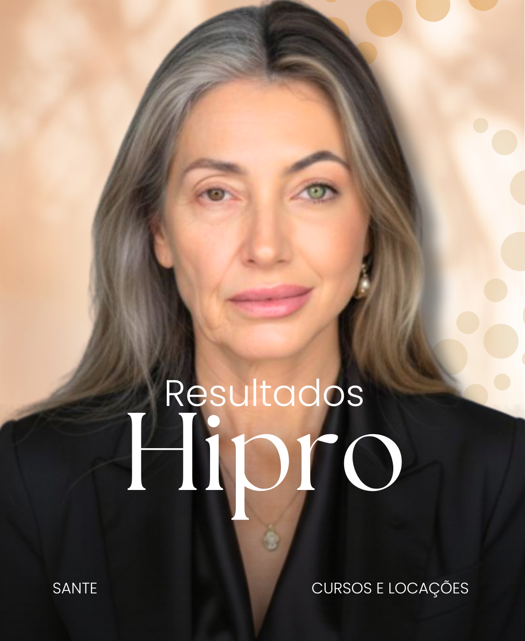 Resultados Hipro